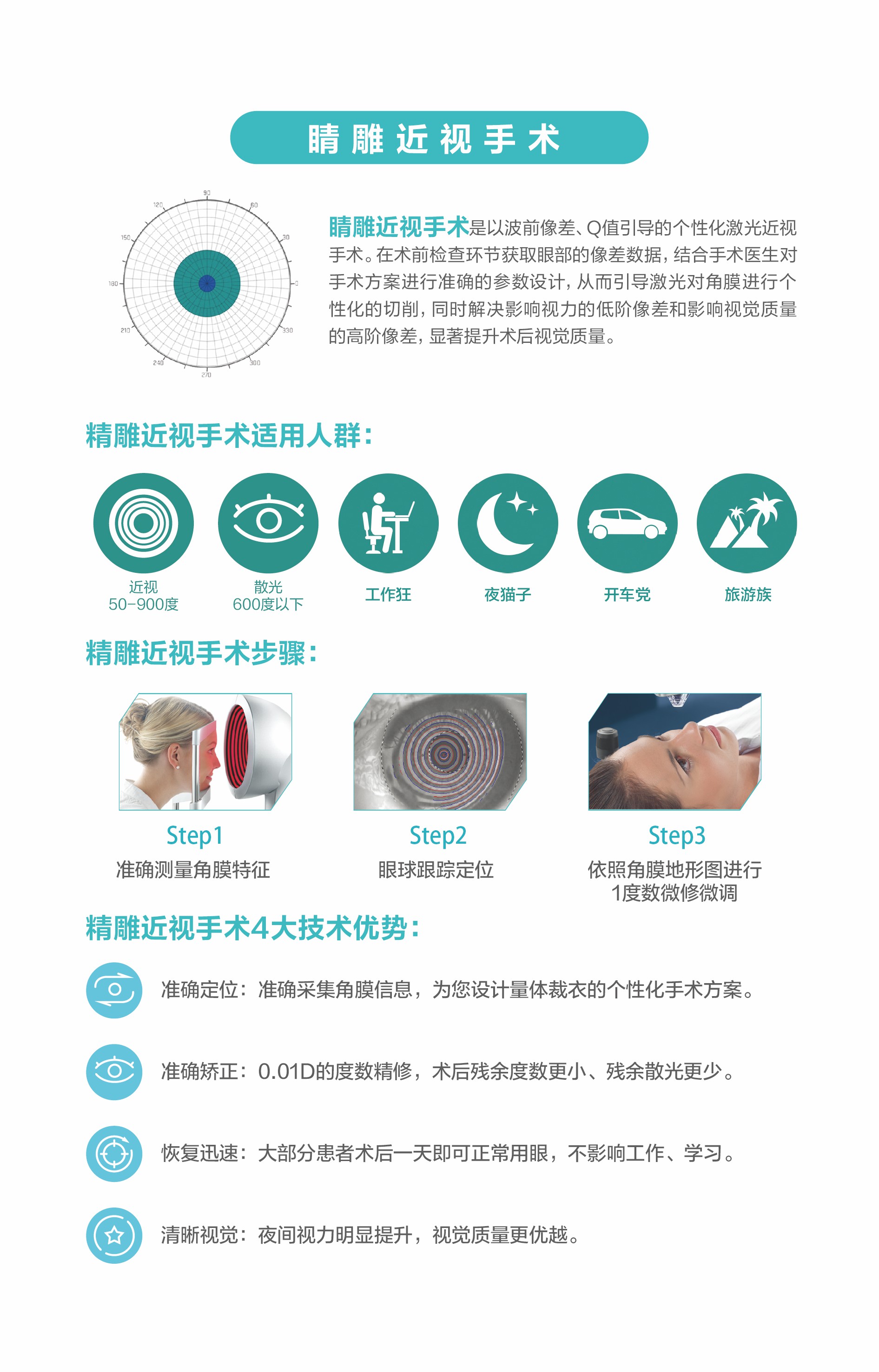 精雕近视手术