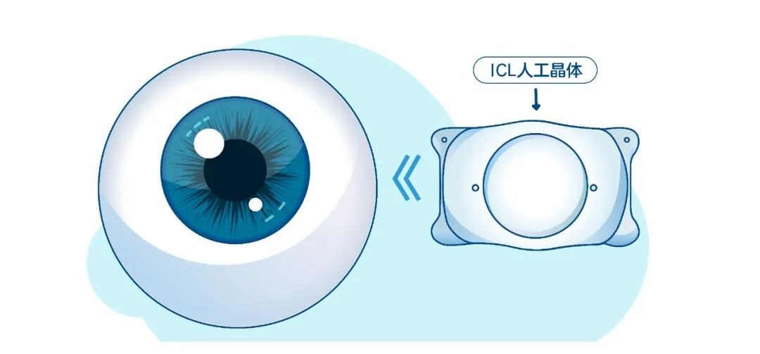 图片.png 图片.png