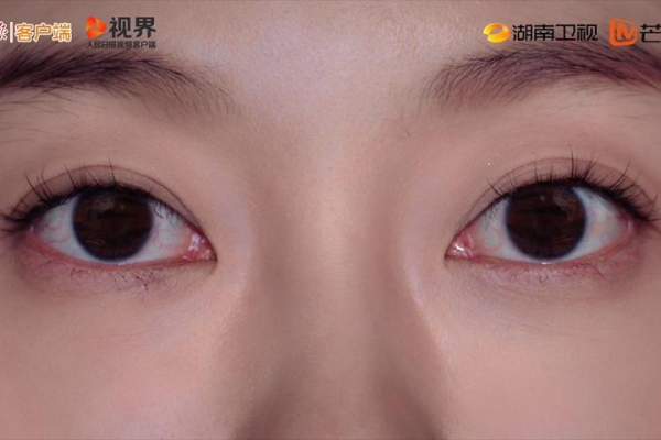 《眼睛的故事》第1集